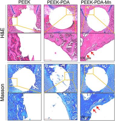 Coating of manganese functional polyetheretherketone implants for osseous interface integration